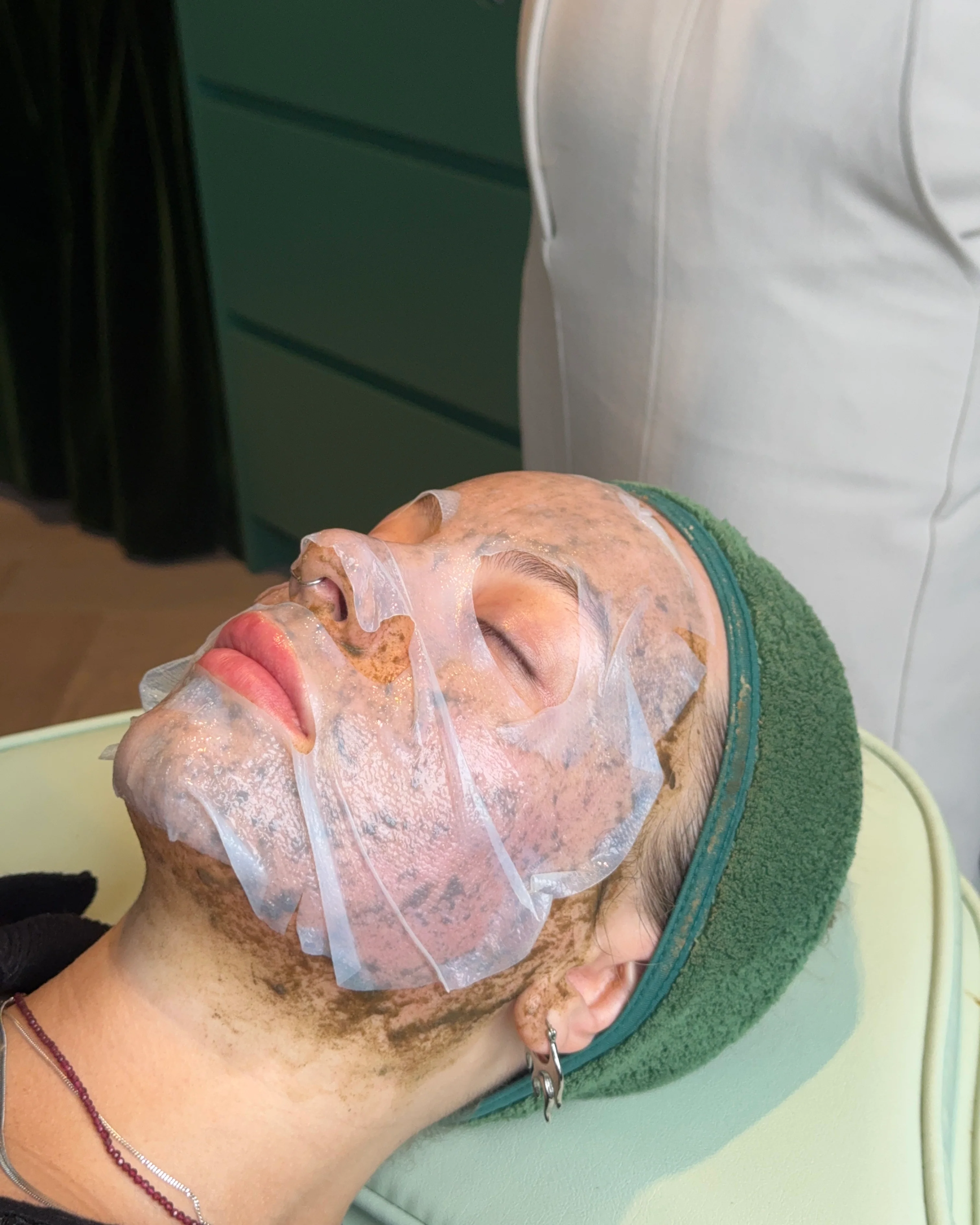 Combination Skin Needling & Spicules x 6 Series - Image 5