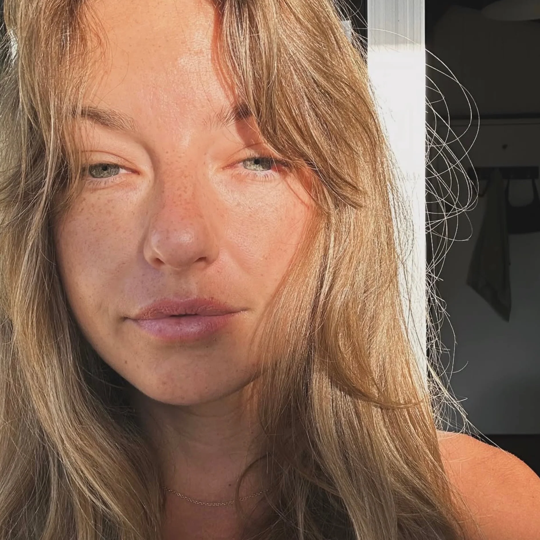 First-Time Enzyme Peel with Consultation & LED - Image 4