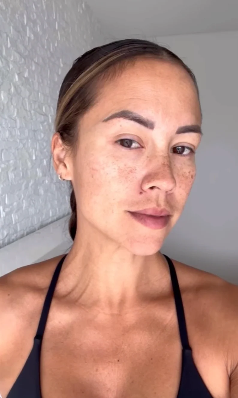First-Time RF Needling with Consultation & LED - Image 5