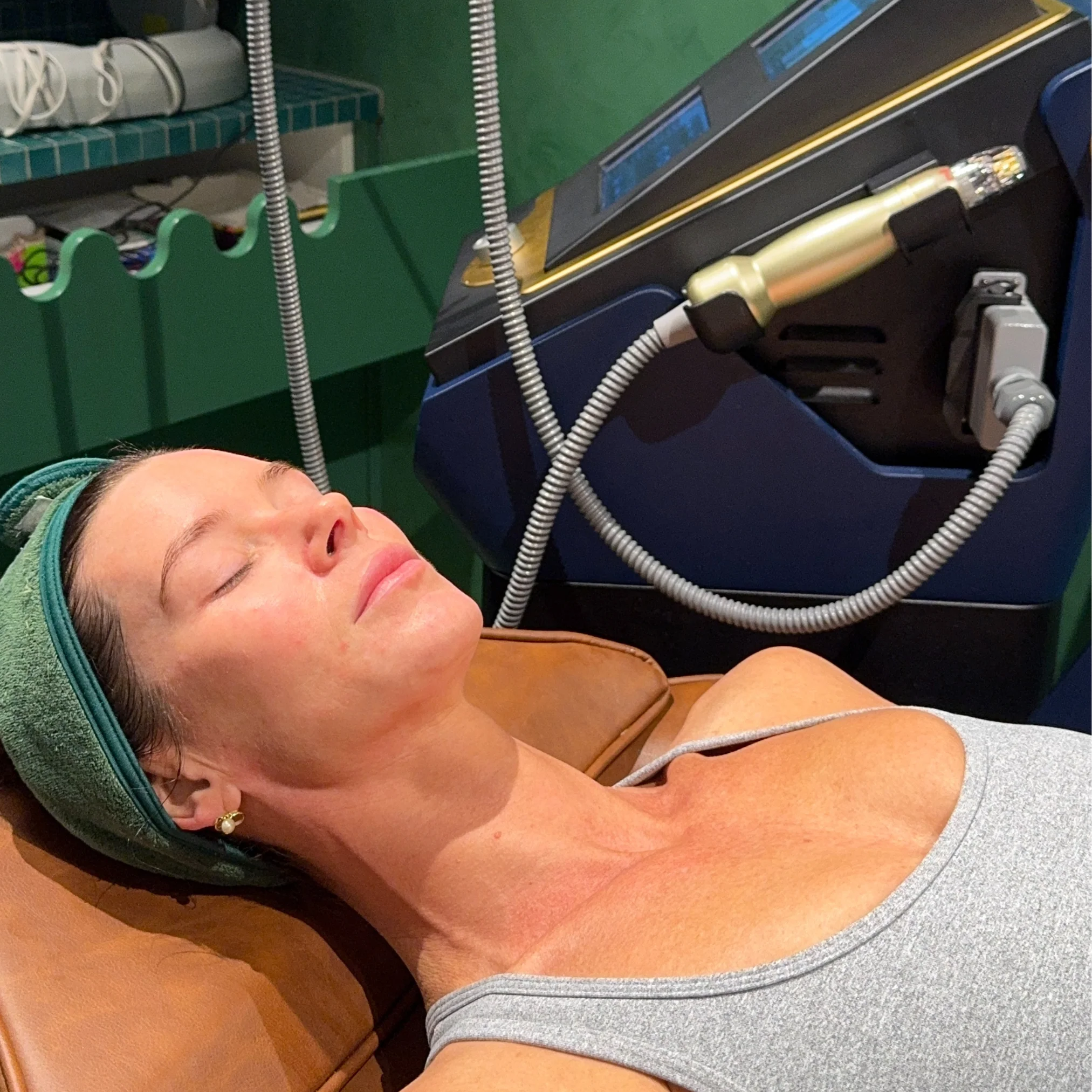 RF Needling x 3 Series - Image 4
