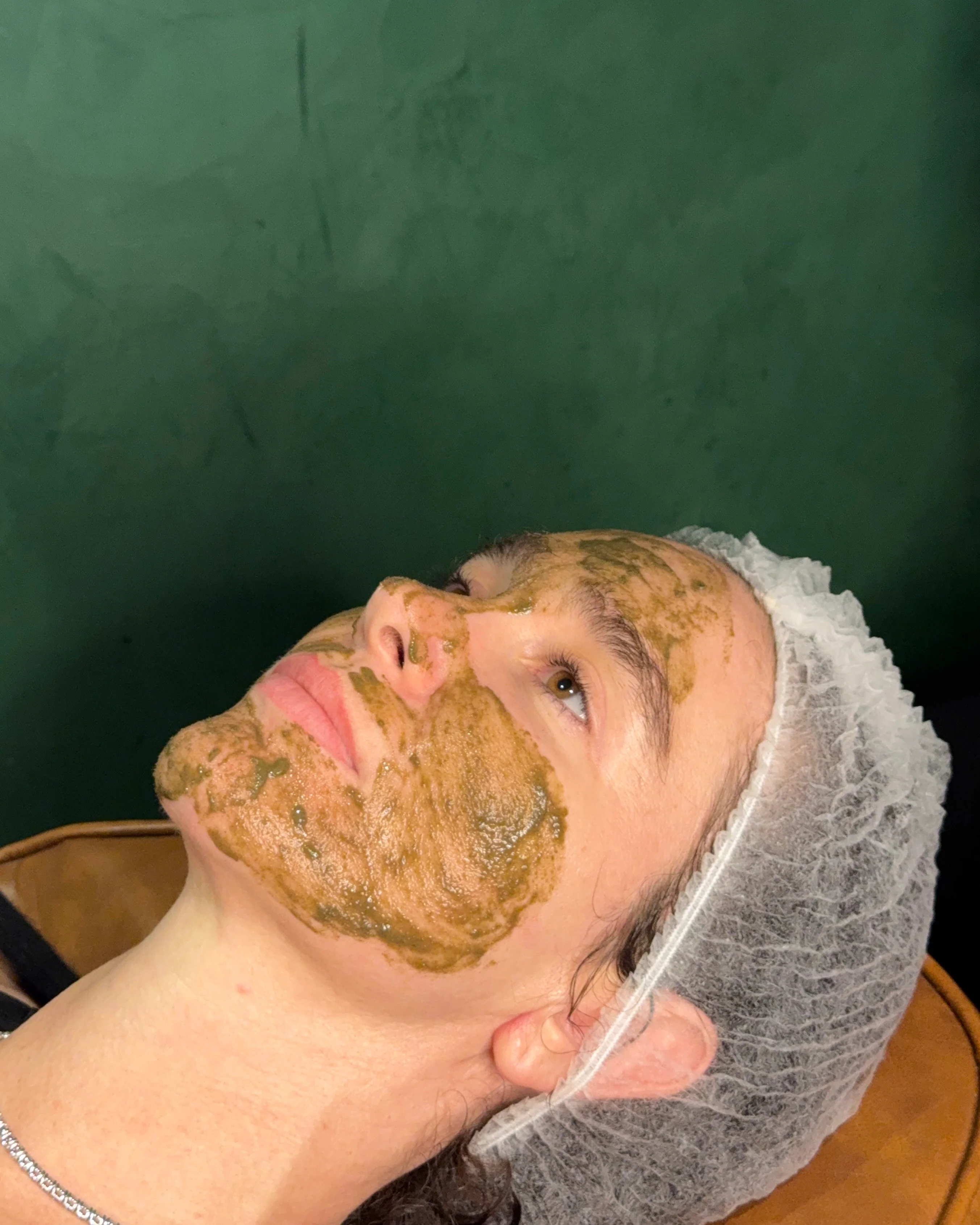 K-Beauty Spicule Treatment - Image 3