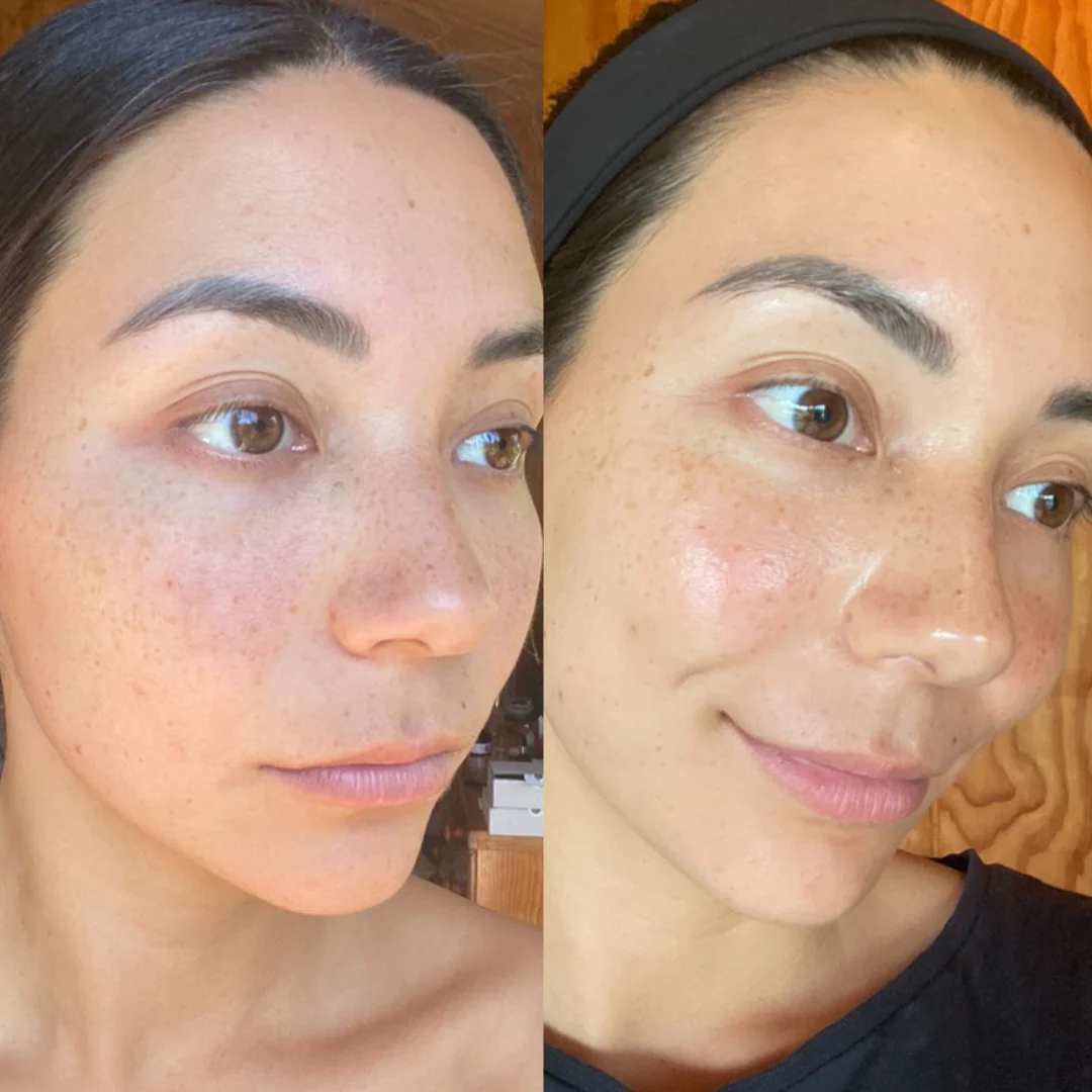 The Facial Kit - Image 3