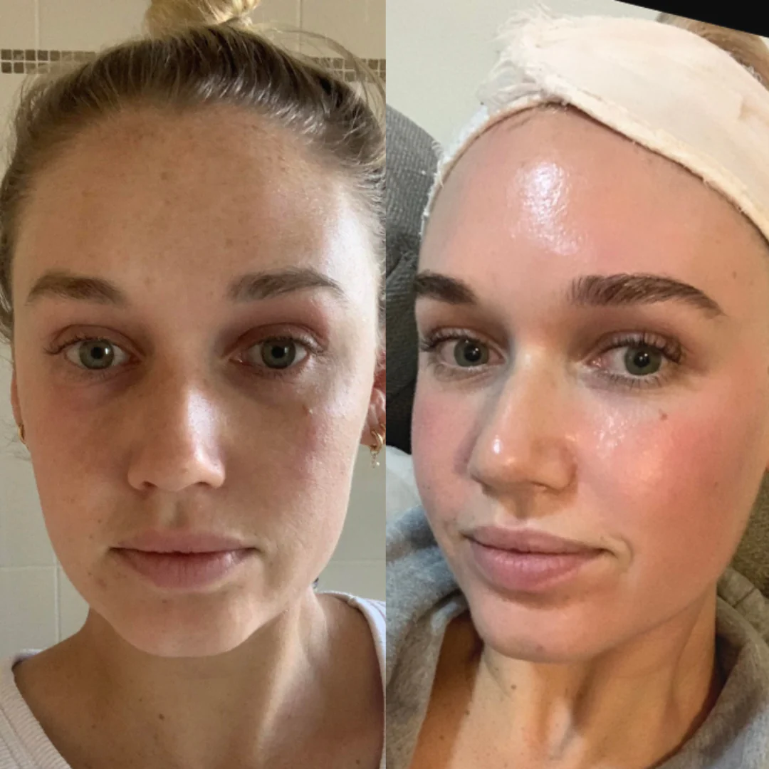 The Facial Kit - Image 4