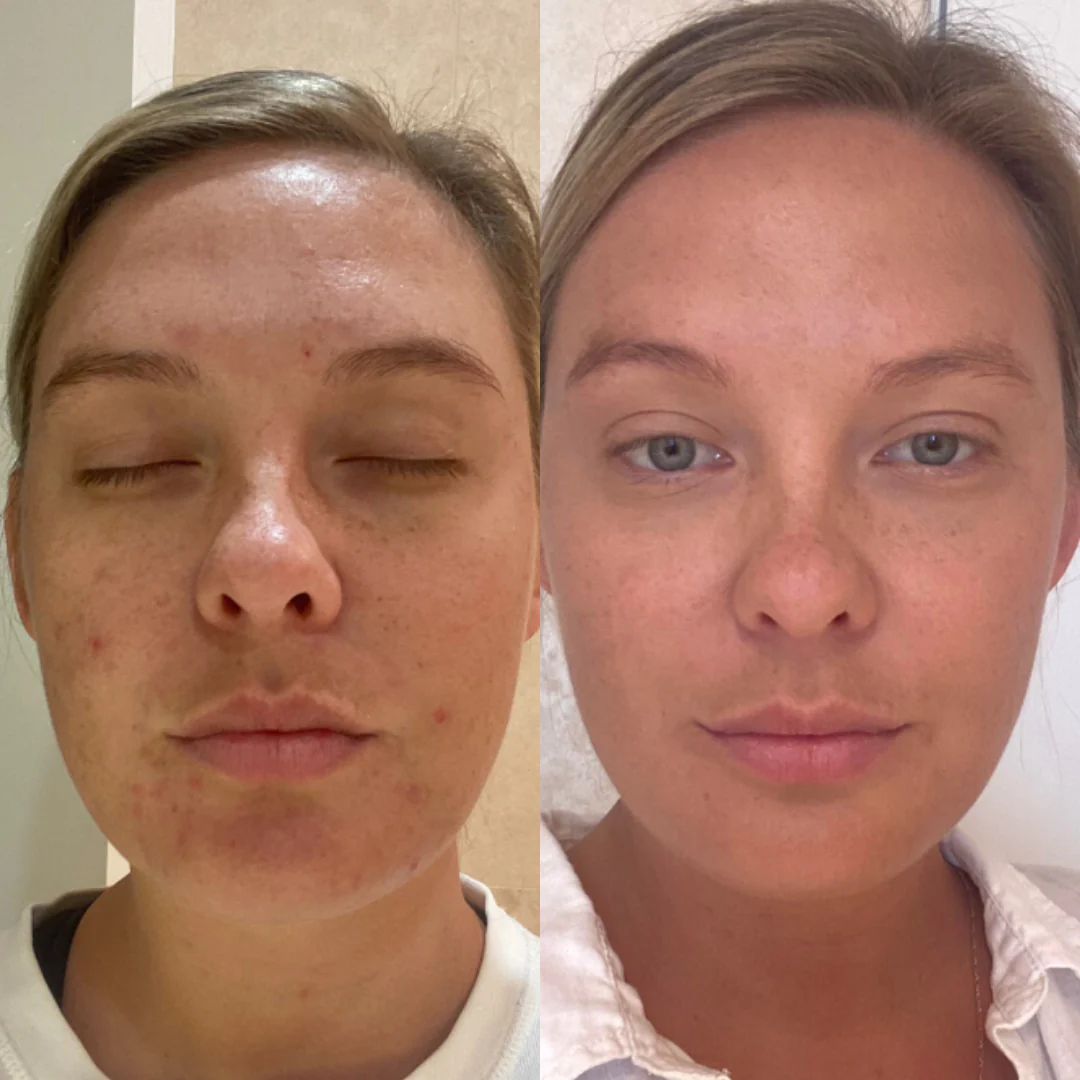 The Facial Kit - Image 5