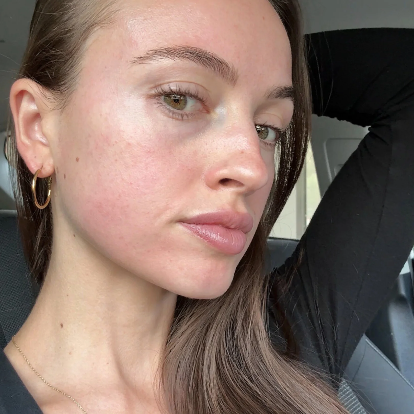 Skin Needling x 3 Series - Image 3