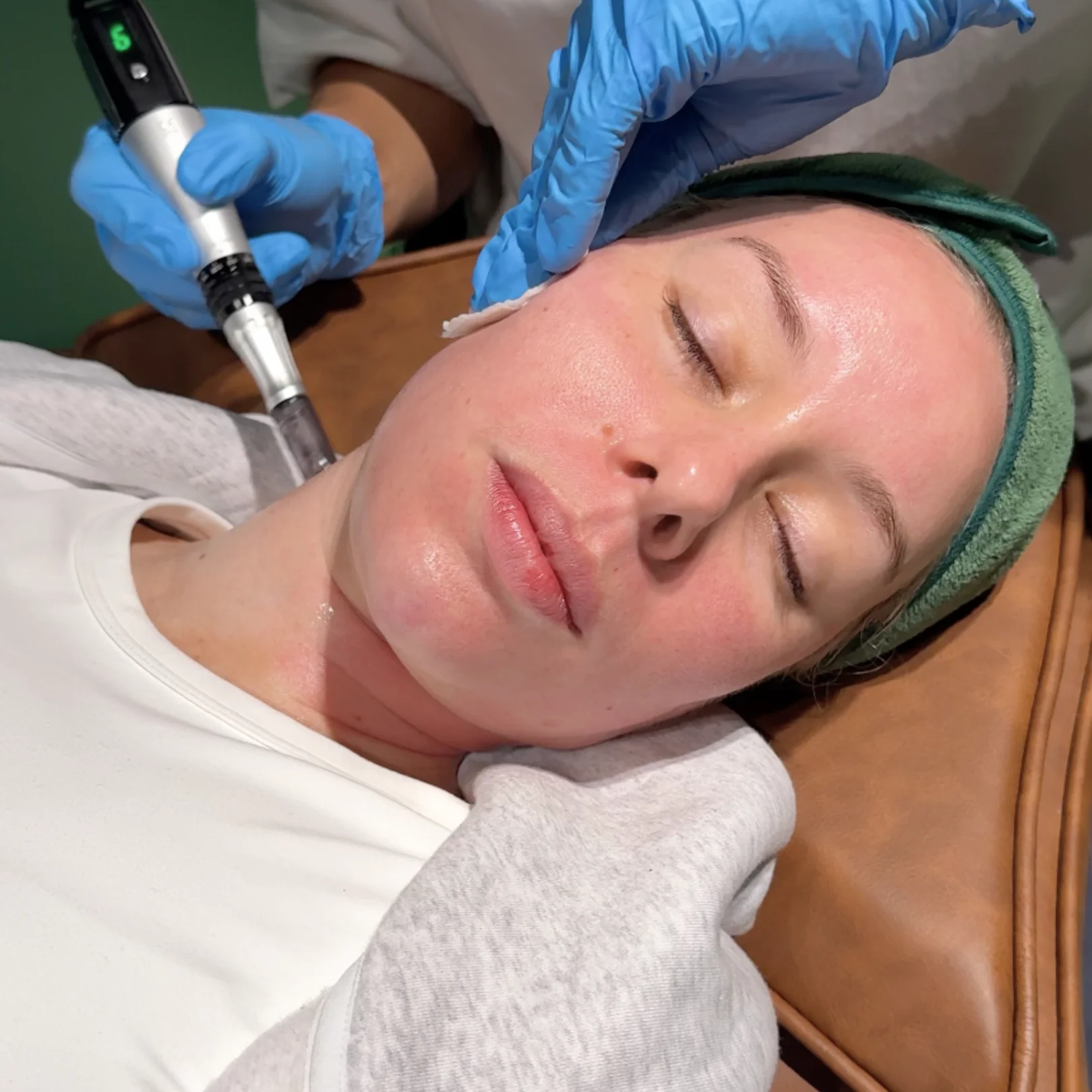 The Smooth, Sculpt & Snatch Treatment - Image 5